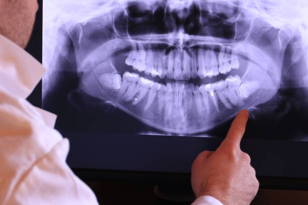 Best Emergency Root Canal Treatment in Jesup, GA